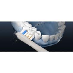 Электрическая зубная щетка Soocas T03 Neos White Фото 10